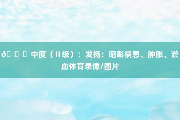👉中度（Ⅱ级）：发扬：昭彰祸患、肿胀、淤血体育录像/图片